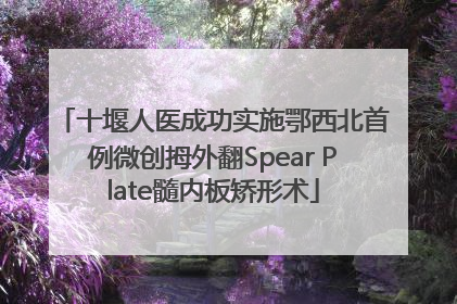 十堰人医成功实施鄂西北首例微创拇外翻Spear Plate髓内板矫形术